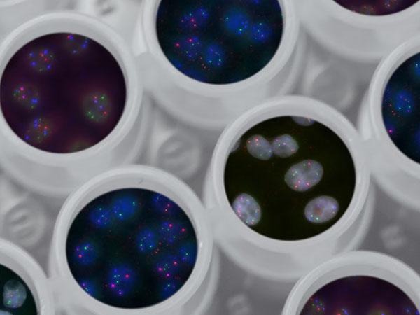 Tochter eines großen medizinischen Labordienstleisters in CH